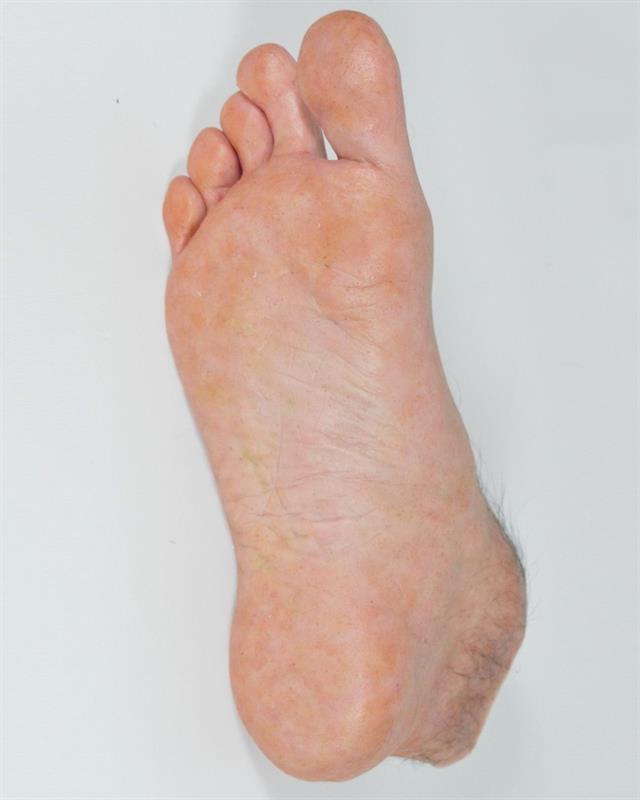 Foot